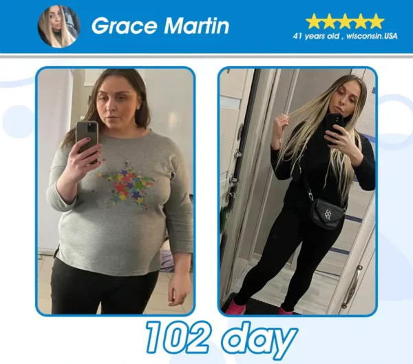 [Official Authorized Store] Cheemex™ GLP-1 Slimming & Health Ultra Concentrated Essence Liquid Pearls – NAD+ Moringa & ACV (✅speedy, long-lasting, addressing diabetes, obesity, and cardiovascular diseases) – ⚡Developed by the Obesity Society
