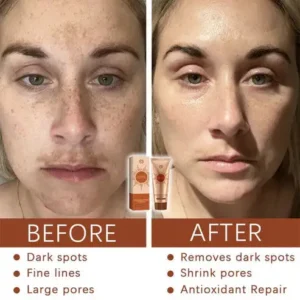 Cheemex® Herbal Spots Peel-Off Facial Mask