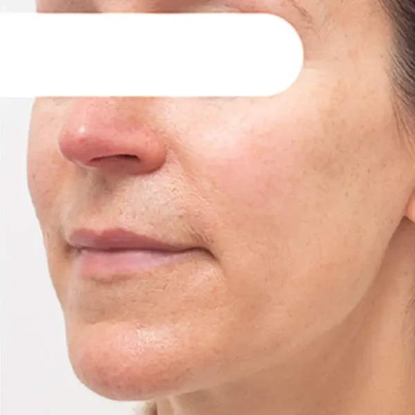 Cheemex® Herbal Spots Peel-Off Facial Mask