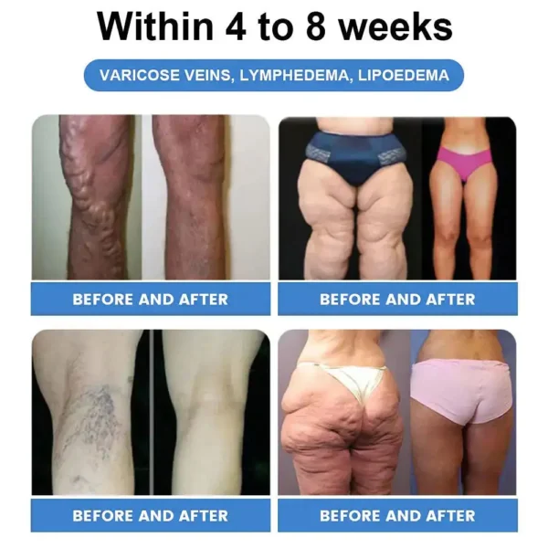 🔥 𝐂𝐥𝐢𝐧𝐢𝐜𝐚𝐥𝐥𝐲 𝐒𝐭𝐮𝐝𝐢𝐞𝐝 | 𝐎𝐟𝐟𝐢𝐜𝐢𝐚𝐥 𝐒𝐭𝐨𝐫𝐞 | Cheemex® 𝐆𝐢𝐧𝐠𝐞𝐫 𝐒𝐥𝐢𝐦𝐦𝐢𝐧𝐠 𝐎𝐢𝐥 – 🌿𝐁𝐞𝐥𝐥𝐲 𝐅𝐚𝐭, 𝐁𝐥𝐨𝐚𝐭𝐢𝐧𝐠, 𝐂𝐞𝐥𝐥𝐮𝐥𝐢𝐭𝐞, 𝐒𝐥𝐨𝐰 𝐌𝐞𝐭𝐚𝐛𝐨𝐥𝐢𝐬𝐦, 𝐋𝐲𝐦𝐩𝐡𝐚𝐭𝐢𝐜 𝐒𝐭𝐚𝐠𝐧𝐚𝐭𝐢𝐨𝐧 & 𝐌𝐨𝐫𝐞