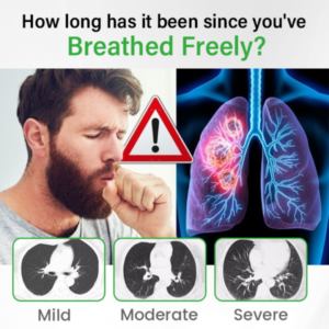 BQYOOM™ SpireFresh Quercetin Lung Detox Inhaler
