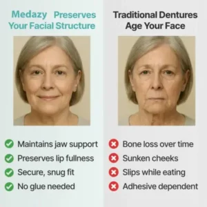 【OFFICIAL STORE】Medazy™ Custom-Fit Full Functional Dentures