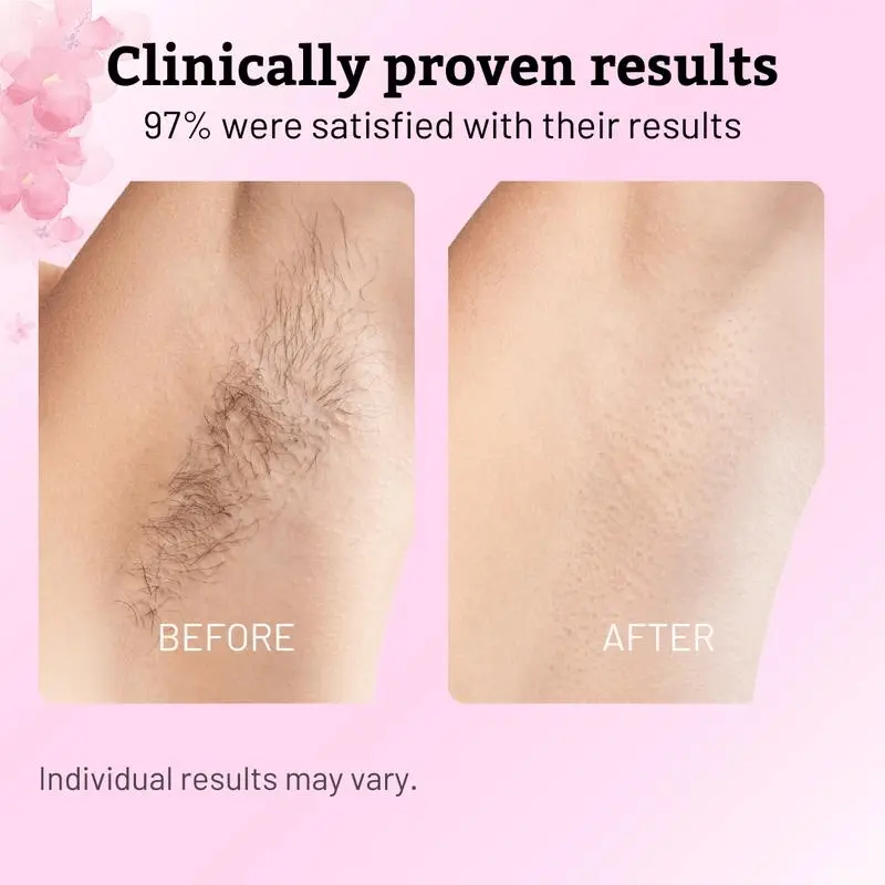 Cheemex Beauty Rotundus Oil for Natural Permanent Hair Reduction