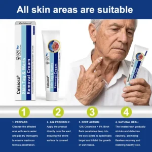 ✨😍Celsiora® Targeted Skin Tag & Wart Removal Cream – Time-Released Phyto-Exfoliant (12% Celandine ) & Bio-Active Terpene Viral-Inhibitor (8% Thuja)