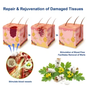 ✨😍Celsiora® Targeted Skin Tag & Wart Removal Cream – Time-Released Phyto-Exfoliant (12% Celandine ) & Bio-Active Terpene Viral-Inhibitor (8% Thuja)