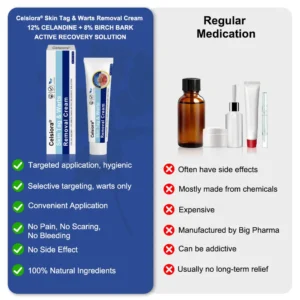 ✨😍Celsiora® Targeted Skin Tag & Wart Removal Cream – Time-Released Phyto-Exfoliant (12% Celandine ) & Bio-Active Terpene Viral-Inhibitor (8% Thuja)
