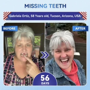 QIAWI® 🦷 Tideglusib Fast‑Dissolving Tooth & Gum Repair Oral Strips 😁 (Supports tooth repair and helps relieve gum discomfort and other common oral concerns)