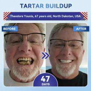 Your Smile~ SmileFitPro® 🦷 Tideglusib Fast‑Dissolving Tooth & Gum Repair Oral Strips ✨ (𝟓-𝐢𝐧-𝟏 💎 𝐑𝐞𝐛𝐮𝐢𝐥𝐝 𝐄𝐧𝐚𝐦𝐞𝐥 & 𝐃𝐞𝐧𝐭𝐢𝐧 • 𝐒𝐭𝐫𝐞𝐧𝐠𝐭𝐡𝐞𝐧 𝐆𝐮𝐦𝐬 • 𝐄𝐫𝐚𝐝𝐢𝐜𝐚𝐭𝐞 𝐓𝐚𝐫𝐭𝐚𝐫 & 𝐎𝐝𝐨𝐫 • 𝐖𝐡𝐢𝐭𝐞𝐧𝐢𝐧𝐠 • 𝐒𝐭𝐨𝐩 𝐓𝐨𝐨𝐭𝐡 𝐒𝐞𝐧𝐬𝐢𝐭𝐢𝐯𝐢𝐭𝐲)