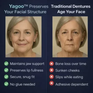 2026🏆✨LAST DAY SALE 60% OFF🔥 Newly upgraded second-generation Yagoo™ complete dentures