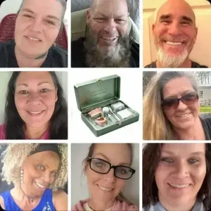 🦷Custom-Fit Dentures | Smile with Confidence