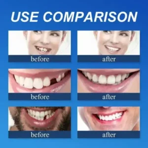 🦷Custom-Fit Dentures | Smile with Confidence