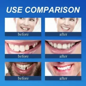 ⏰Ends Today: 70% OFF! 🌎KLENIMORE™ Custom-Fit Dentures— Designed for Comfort and a Natural-Looking Smile