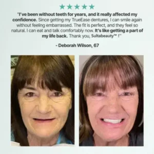 Sultabeauty™ Full Denture