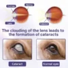 Timilk® NanoCare Pet Eye Drops